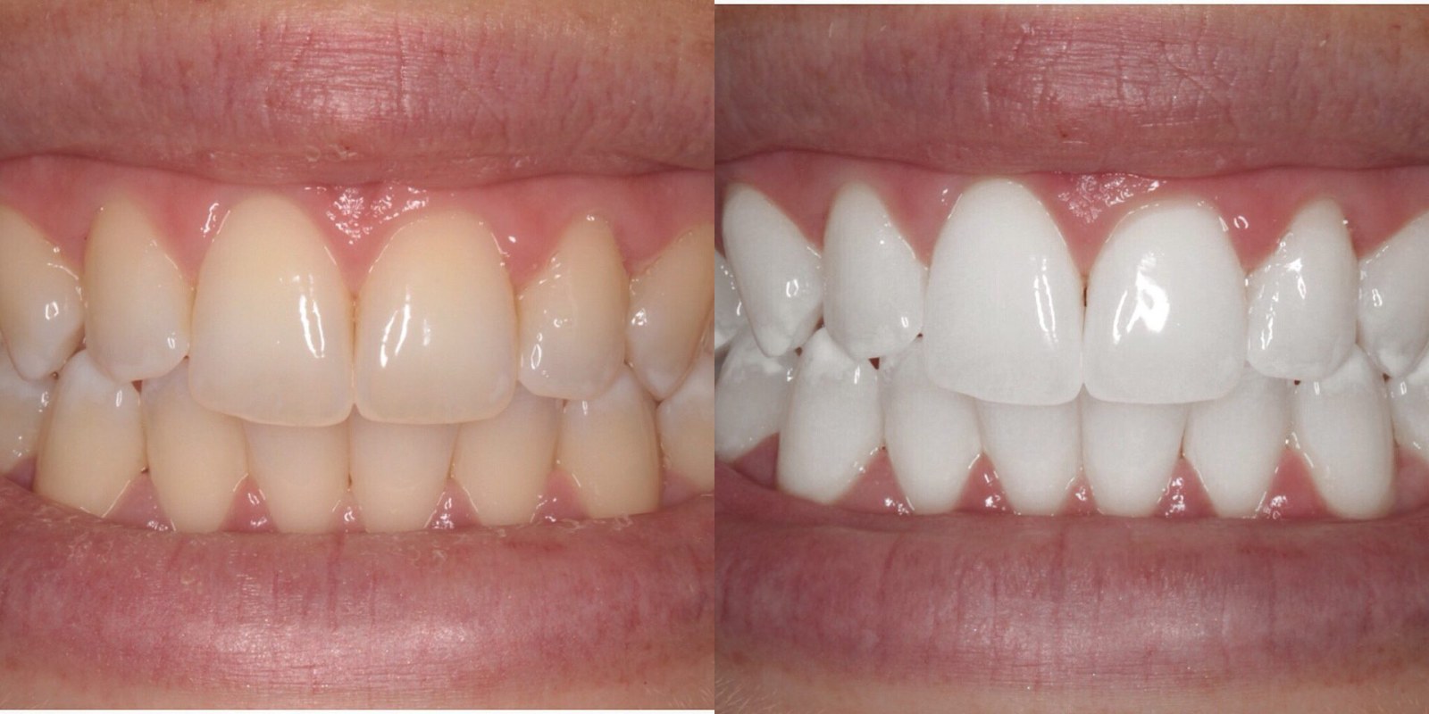 Cosmetic Dentistry