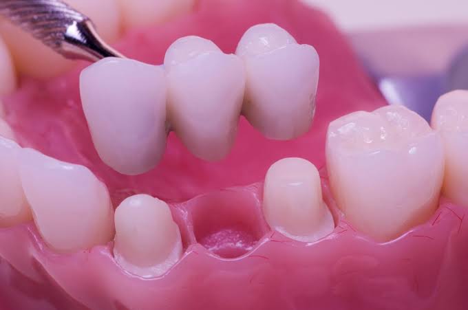 Prosthodontics