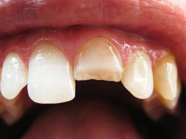 Emergency Dentistry