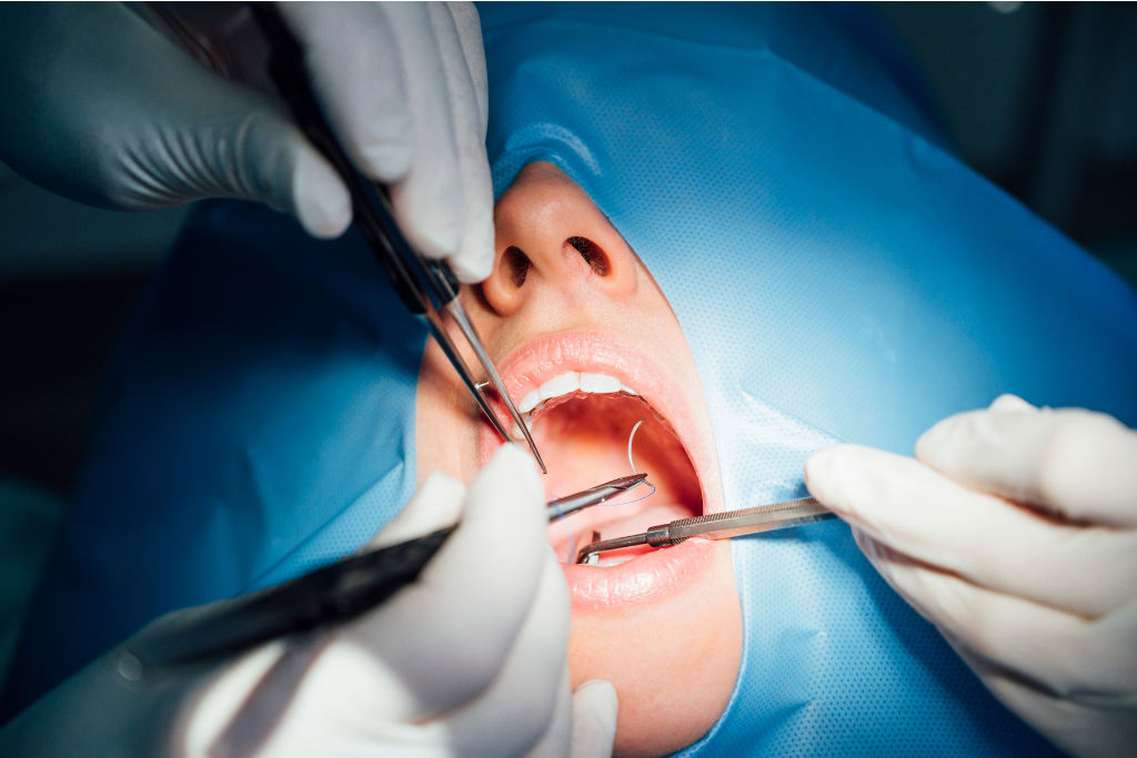 Oral & Maxillofacial Surgery