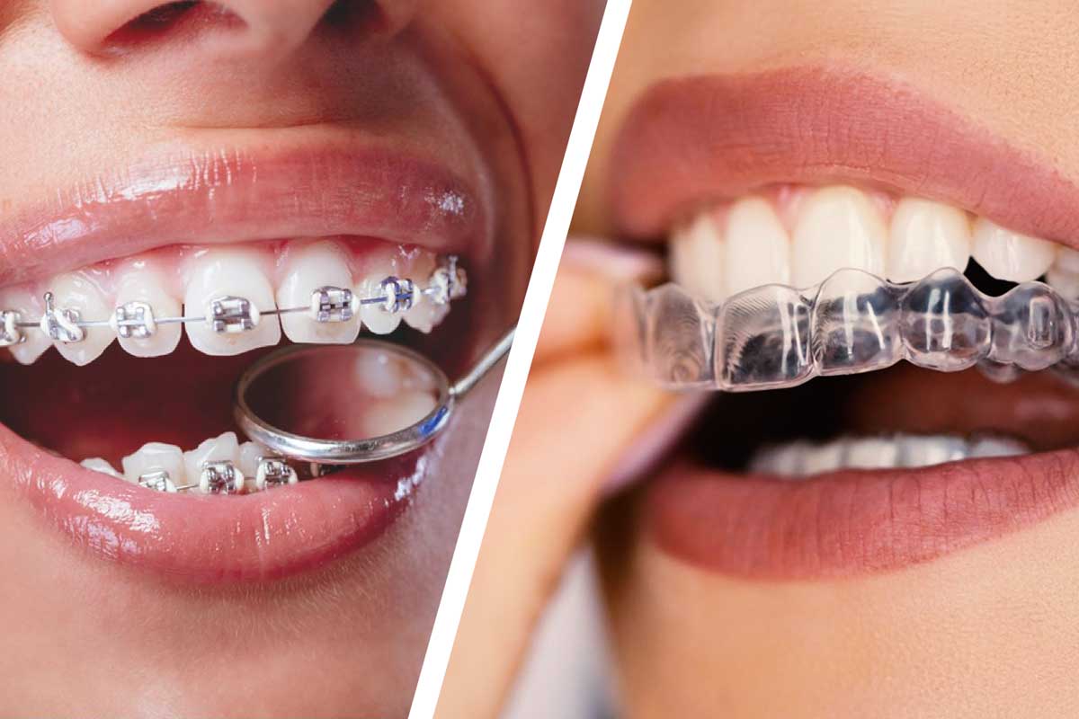 Orthodontics