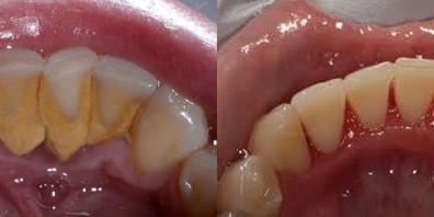 Periodontal Dentistry